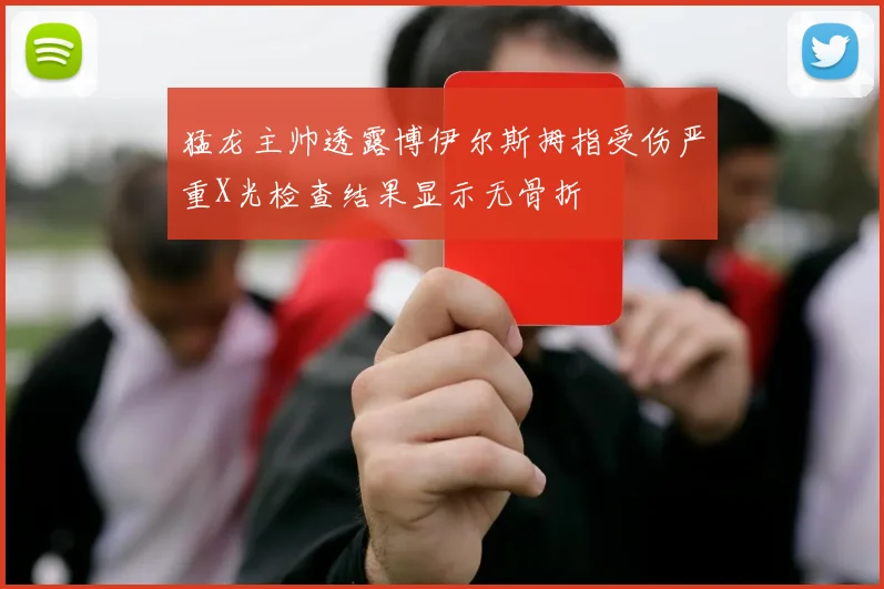 猛龙主帅透露博伊尔斯拇指受伤严重X光检查结果显示无骨折